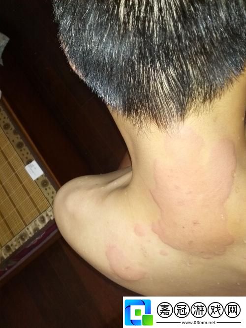 科技新潮流-疙瘩塊揭秘：肌膚遭遇創意翻車現場