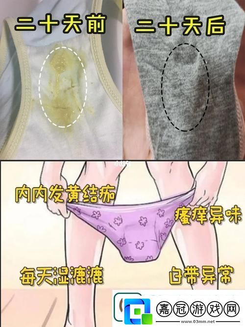 內(nèi)褲弄成一條線摩擦?xí)趺礃?揭開日常生活中的小秘密